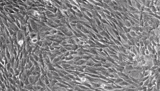 人骨骼肌细胞永生化的运输和保存及使用方法！