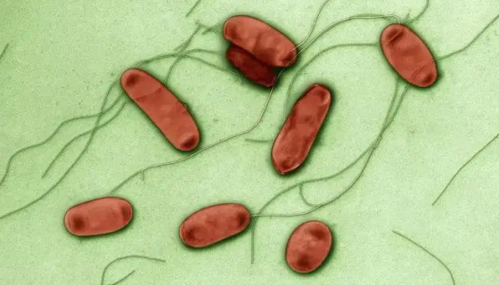 军团菌——隐藏在空调里的“杀手”！