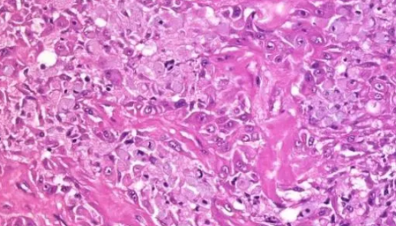 LTEP-S人肺鳞癌细胞收到后的处理方法与培养步骤！