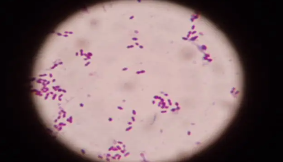 肺炎链球菌的培养特性与生化反应及鉴别要点！