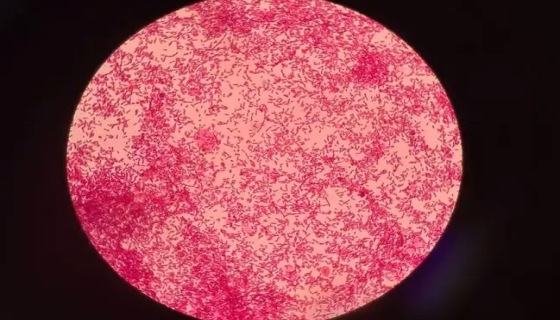 流感嗜血杆菌的症状诊断及预防与治疗！