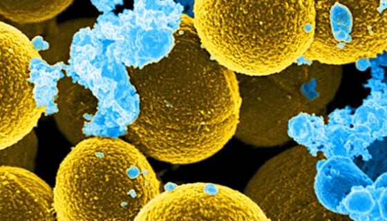 ATCC 29213金黄色葡萄球菌金黄亚种的注意事项！