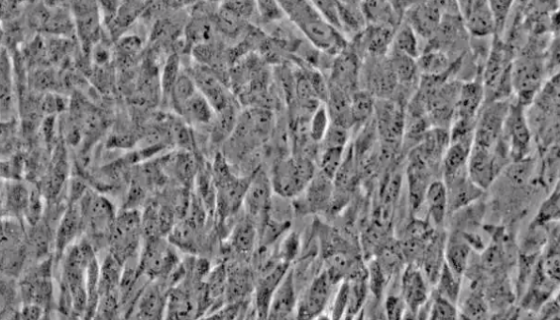 人血管平滑肌细胞的培养步骤与注意事项！