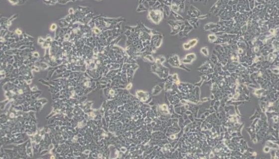 LOVO/5FU 人结直肠癌细胞氟尿嘧啶耐药株