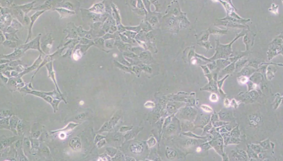 HMC3 (人小胶质细胞)的处理方法与培养步骤！