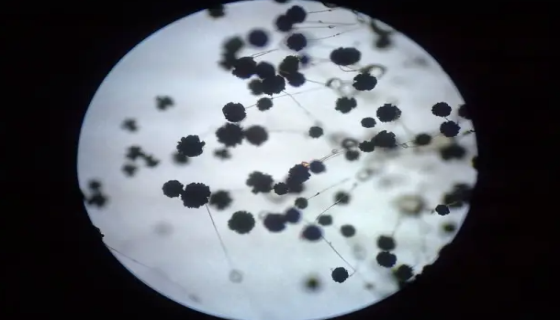 黑曲霉的广泛应用及基因与蛋白质组学的相关研究！