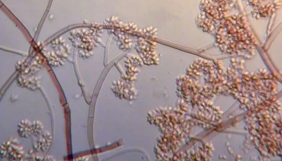 灰葡萄孢的菌株说明与采集地及形态描述！