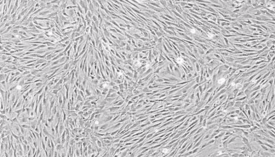 小鼠胰岛素瘤胰岛Β细胞的处理方法与培养步骤！