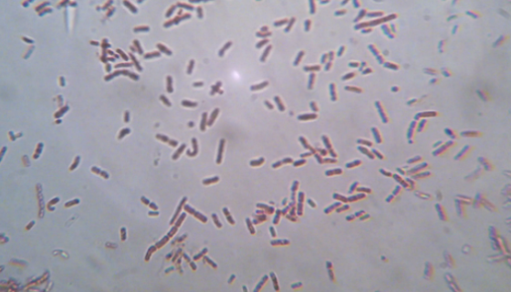 蜡样芽孢杆菌食物中毒情况与原因及风险防控建议！