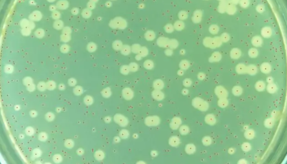 铜绿假单胞杆菌的培养特性与临床表现及诊断与预防！