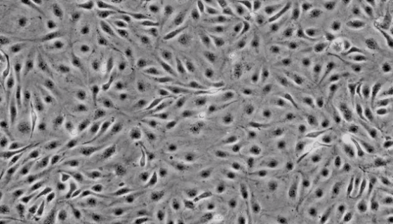 人肺微血管内皮细胞接收后的操作流程与注意事项！