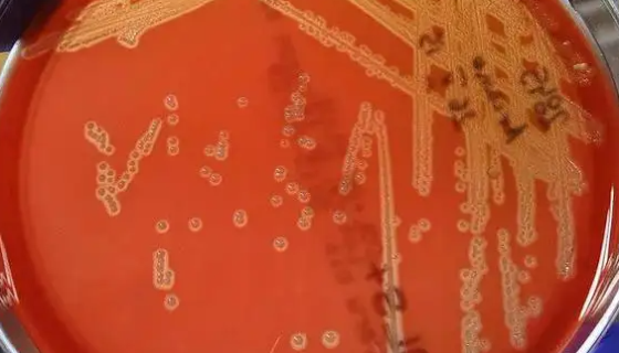 ATCC 55618 产琥珀酸放线杆菌的培养方法与实验内容！