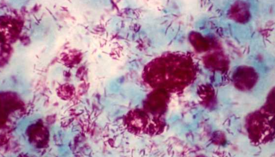 ATCC 19250 蟾分枝杆菌的培养条件与注意事项！