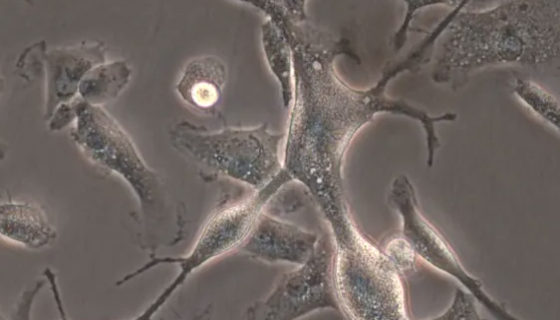 人海马神经元细胞HPPNCs验收注意事项及培养步骤！