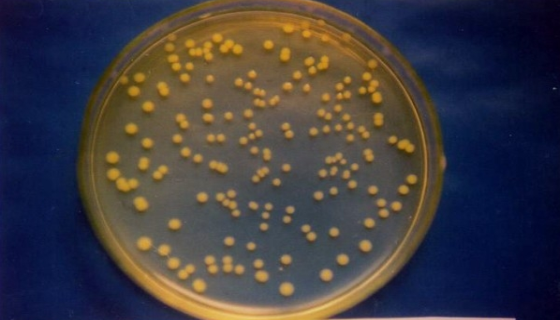 荧光假单胞菌的培养特征与分离筛选及作用机制！