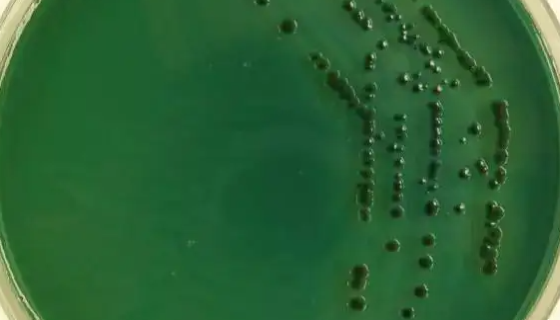 副溶血弧菌的菌株性质与生存环境及检测方法！