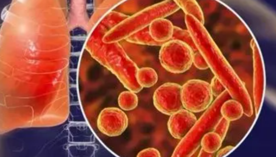 猪支原体肺炎的知识简介与临床症状及防控措施！