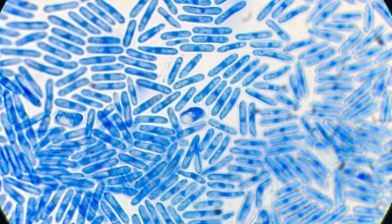 瓜类刺盘孢菌的形态特征与主要价值及保存方法！