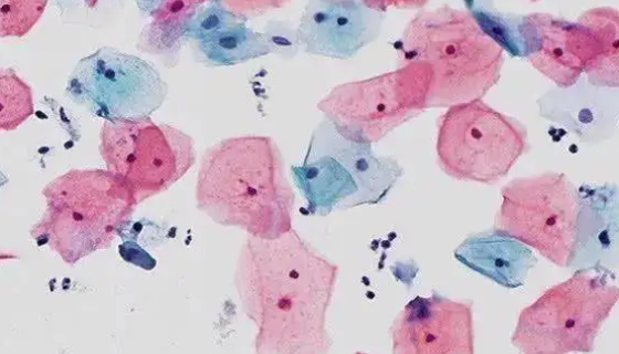 Hela人宫颈癌细胞的处理与培养步骤及相关研究！