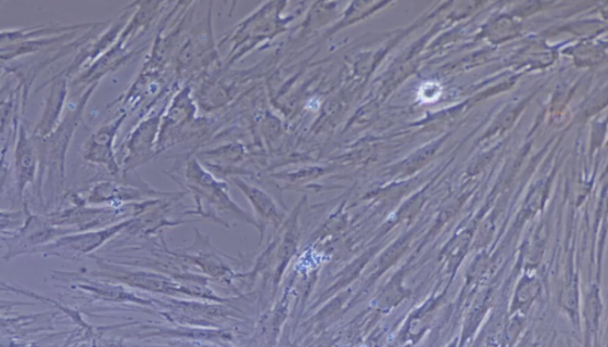 人牙周膜干细胞系HPLIS的运输和保存及注意事项！