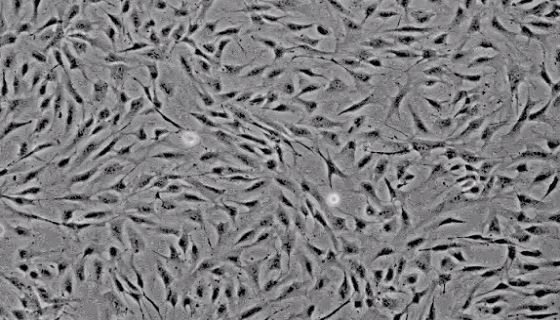 原代细胞——人脑血管周细胞的背景与应用！