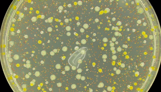 产碱假单胞菌的培养条件与实验内容及打管说明！
