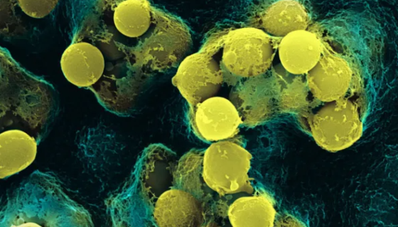 藤黄微球菌——四联球菌的典型代表