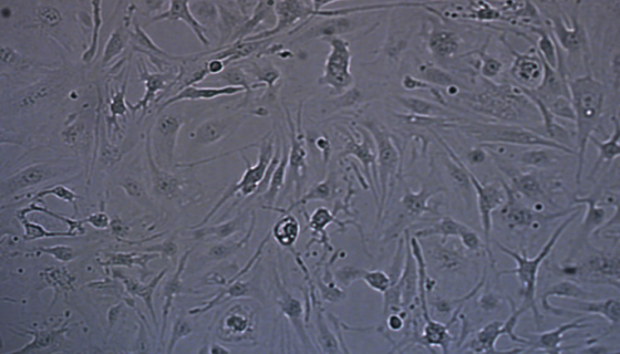 小鼠脑微血管内皮细胞的体外培养与相关研究！