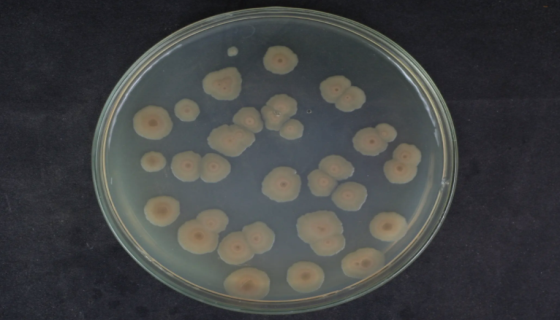 嗜碱芽孢杆菌的培养条件与注意事项及打管说明！