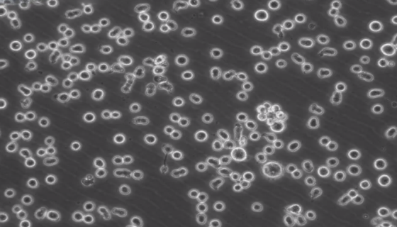 小鼠T淋巴细胞的培养步骤与应用！