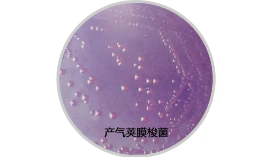 产气荚膜梭菌的培养特性与生化反应及作用机理！