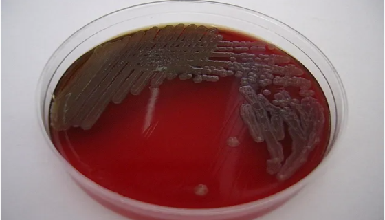 气单胞菌属的生物学特性与微生物学检验！