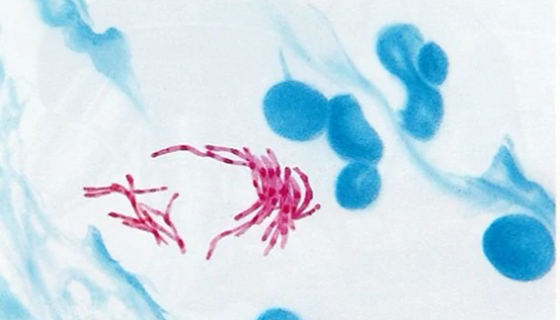 分枝杆菌的知识解析与形态特征及主要分类！