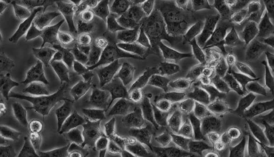 CALU-3 人肺腺癌细胞的应用与培养步骤！