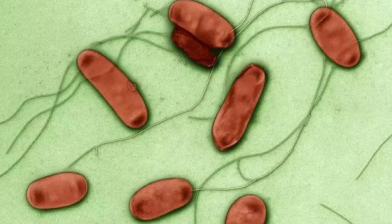 嗜肺军团菌的发病机理与微生物检查及防治原则！