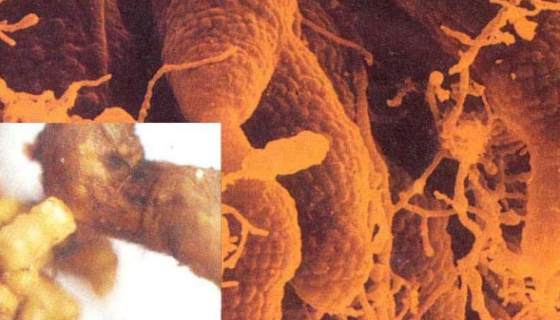 普沙根瘤菌的形态特征与主要价值及注意事项！