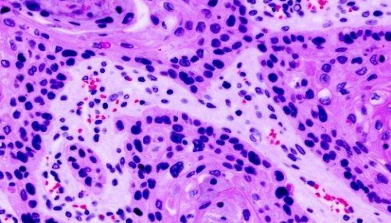 NCI-H446 人小细胞肺癌细胞的应用！