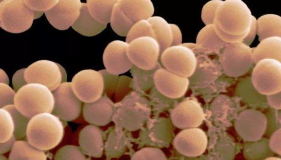 表皮葡萄球菌的注意事项与保藏方法！