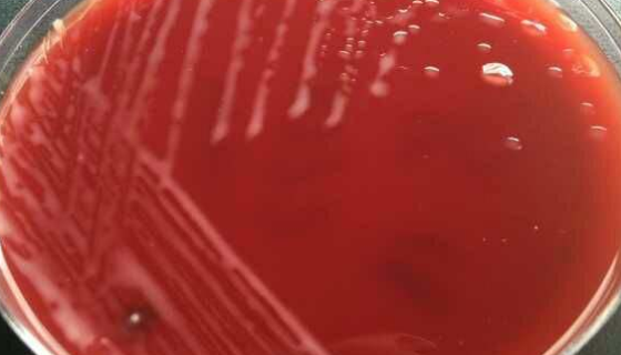 ATCC 12974 带化红球菌的知识解析与产品优势！