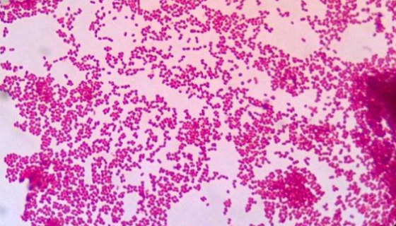 ATCC 14987乙酸钙不动杆菌的形态特征与主要价值！