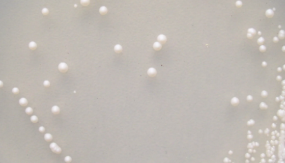 酿酒酵母的主要价值与应用方向及相关研究！