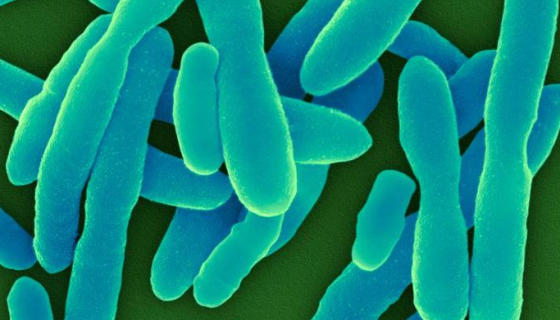 铜绿假单胞菌是什么？对人体有什么危害？