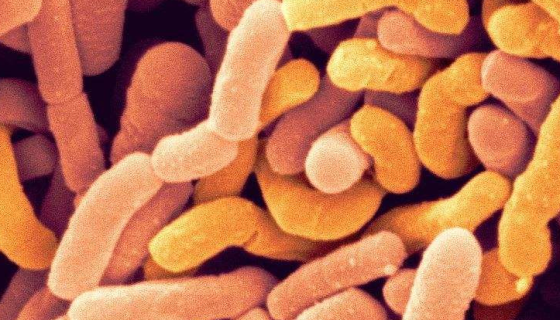 用于有机化工废水处理的：微杆菌属