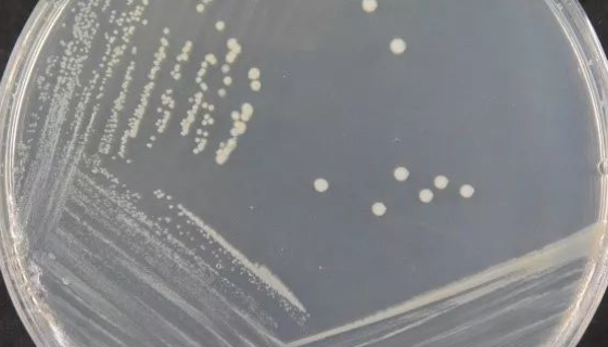 假交替单胞菌属的培养条件与注意事项！