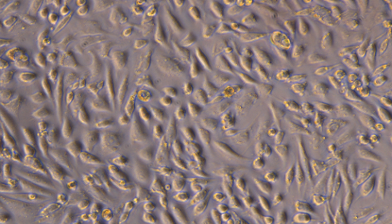 小鼠卵巢上皮癌细胞+Luc的处理方法与培养步骤！