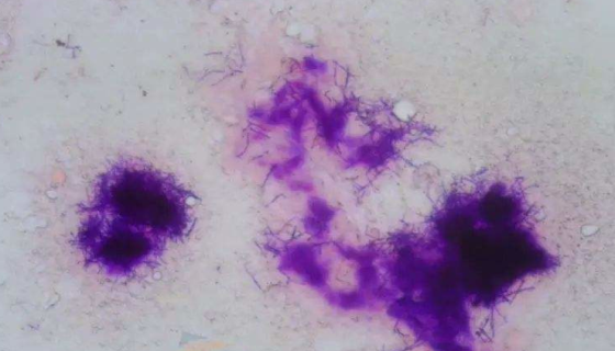 星状诺卡氏菌的使用范围与培养方法及打管说明！