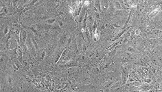 小鼠肾足细胞的培养步骤与处理方法及应用！