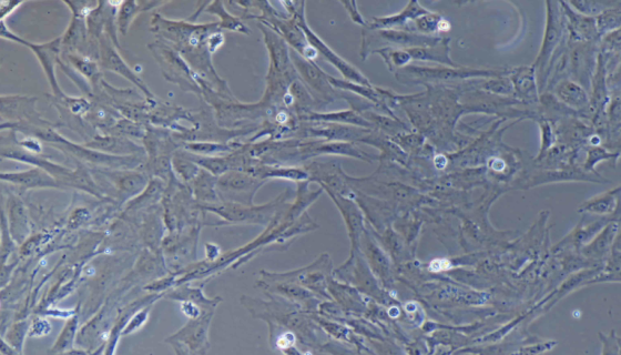 KGN 人卵巢颗粒细胞的培养步骤与处理方法！
