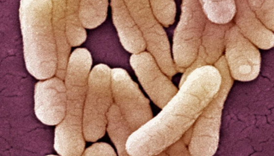 鼠伤寒沙门菌的生化特征与临床表现及治疗与预防！