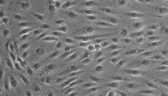 EA.hy926（人脐静脉细胞融合细胞）的注意事项！